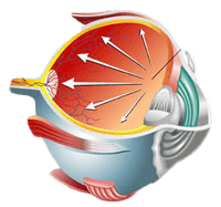 Glaucoma Diagram